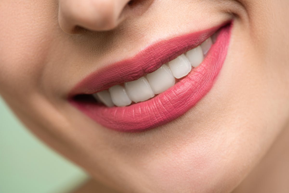 Sorriso perfetto dopo trattamento estetico dentale